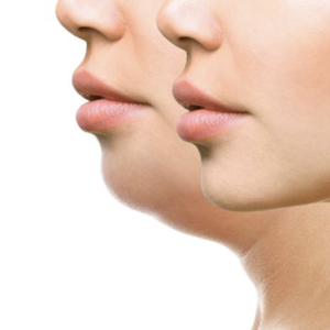 Lipoenzimas (sesión)